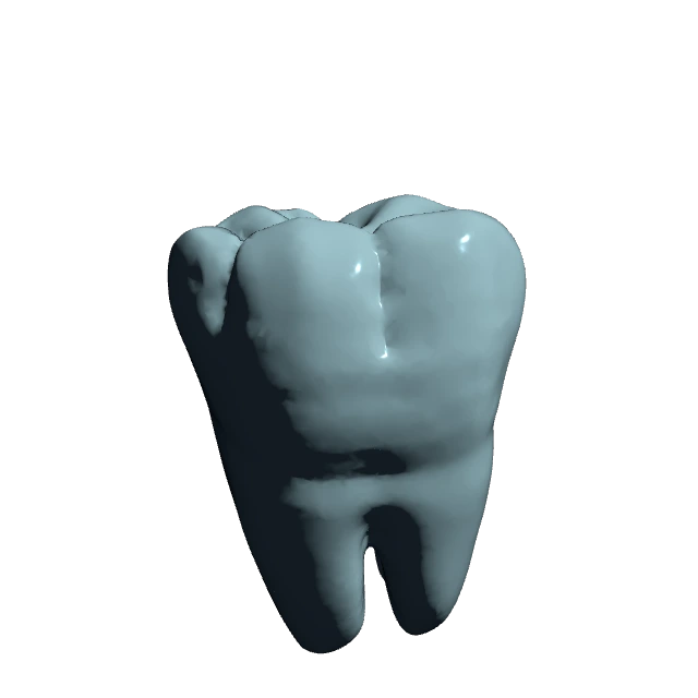 3D model glazirane cirkonske krunice